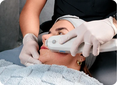 Tratamiento Ultherapy 2